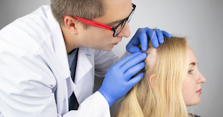 Alopecia Areata