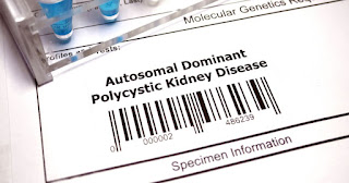 Polycystic Kidney Disease