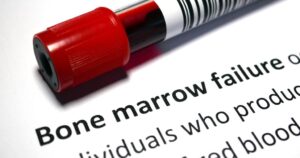 Bone Marrow: The Lifeline of Healing and Hope