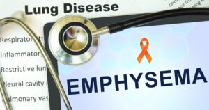 Emphysema Awareness: Understanding, Preventing, and Supporting Those Affected