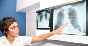 Understanding Pulmonary Hypertension: A Comprehensive Guide