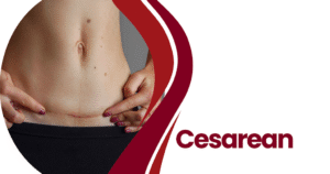 The Essential Guide to Cesarean Awareness Month: Education, Support, and Advocacy